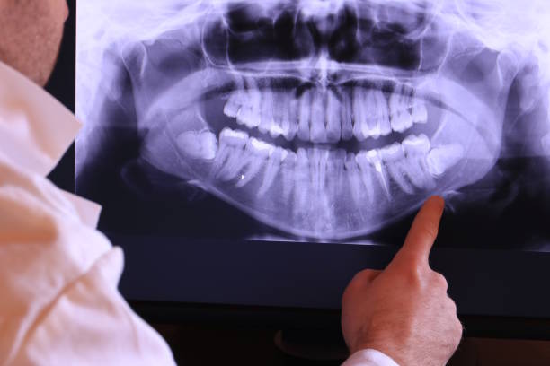 Best Root Canal Emergency Dentist  in Shasta Lake, CA